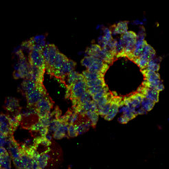 organoid