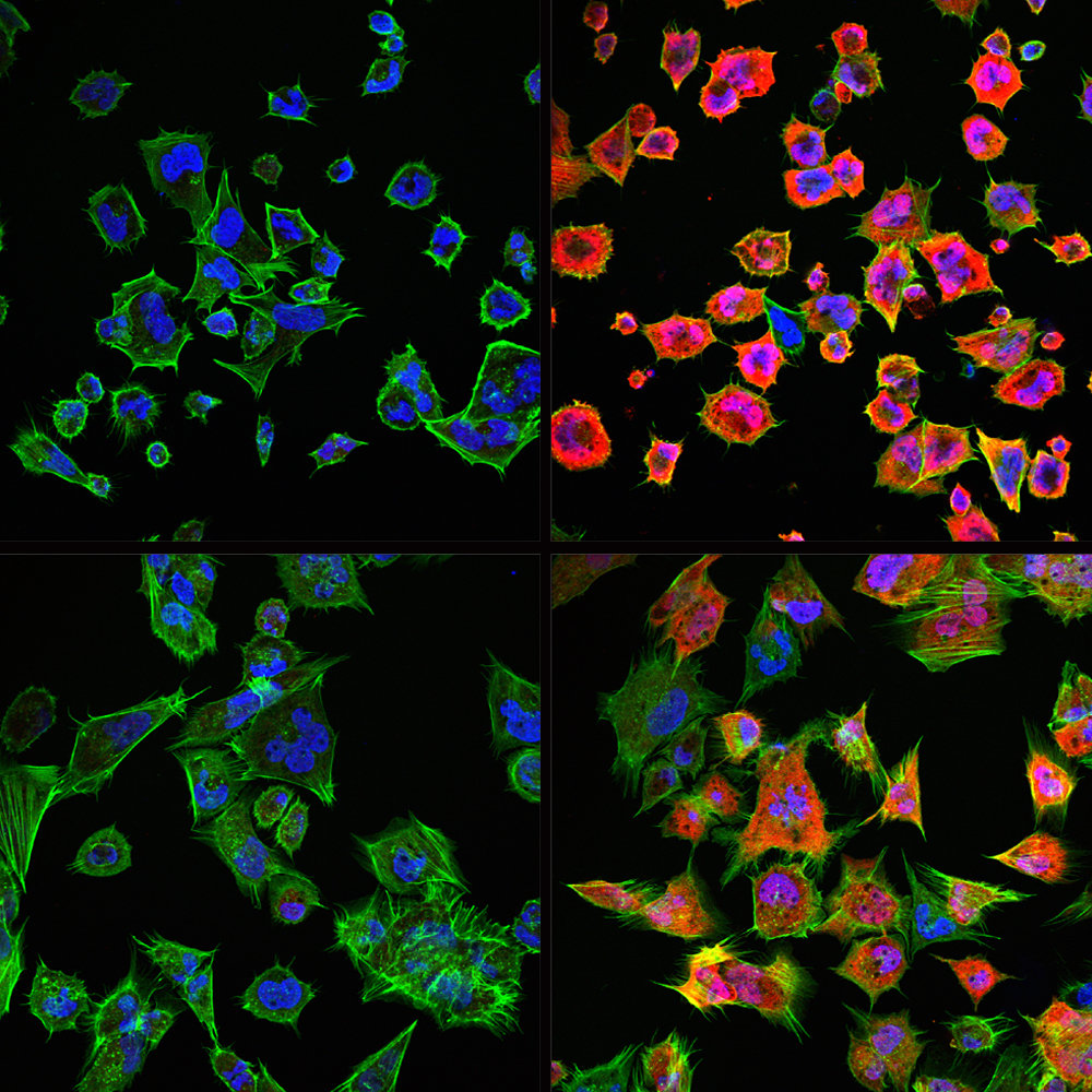 Electroporated recombinant proteins as tools for in vivo functional complementation, imaging, and chemical biology