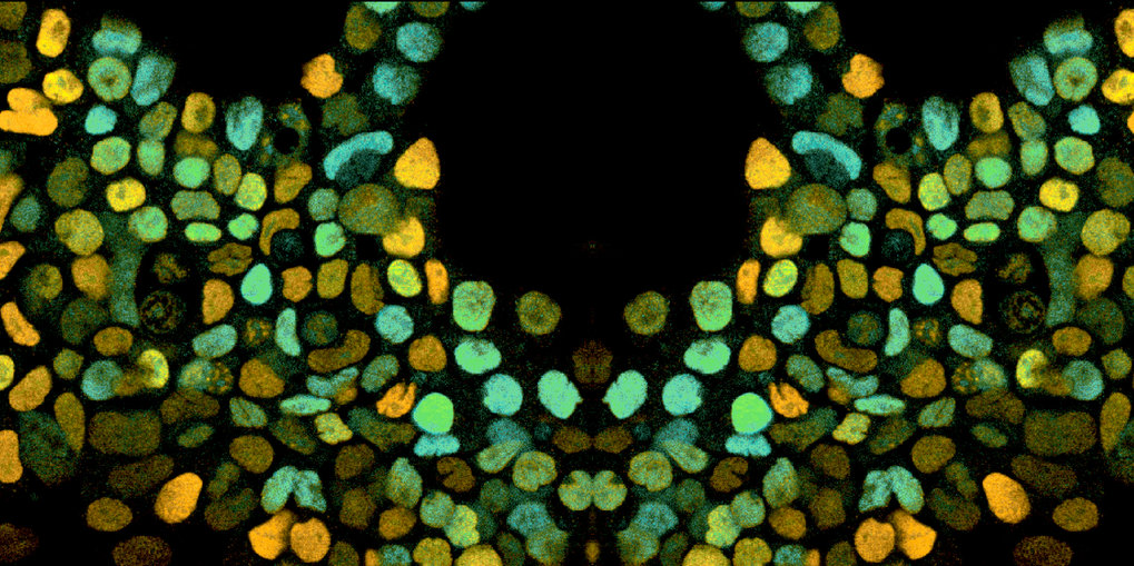 <p>Research funds for measuring the speed of life</p>