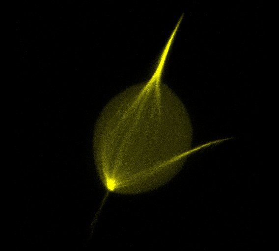 A self-organized synthetic morphogenic liposome responds with shape changes to local light cues