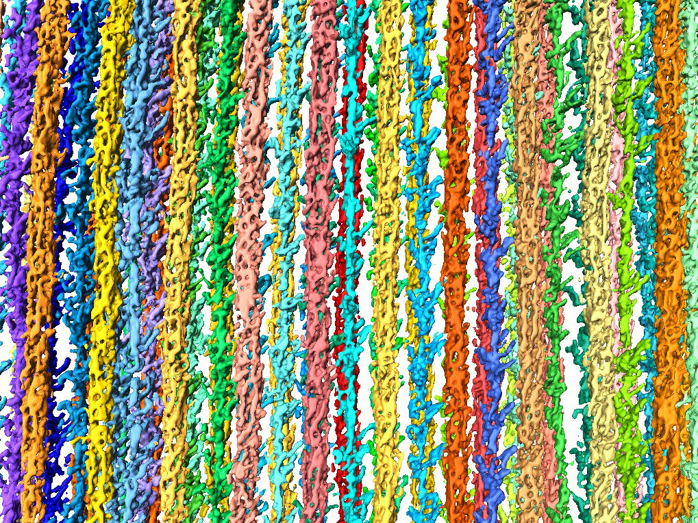 Zooming in on Muscle Cells
