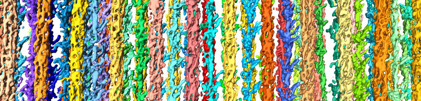Zooming in on Muscle Cells Zooming in on Muscle Cells