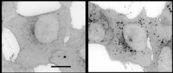 Cholesterol (black) is found in the cell mainly in the membrane and in the lysosomes (left picture). Treatment of cells with the identified active substances from the cluster causes accumulation of cholesterol in the lysosomes (right picture).