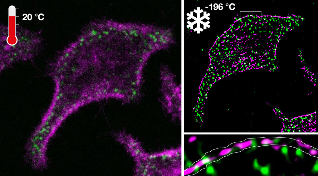 Ultrarapid cryo-arrest of living cells on a microscope enables multiscale imaging of out-of-equilibrium molecular patterns