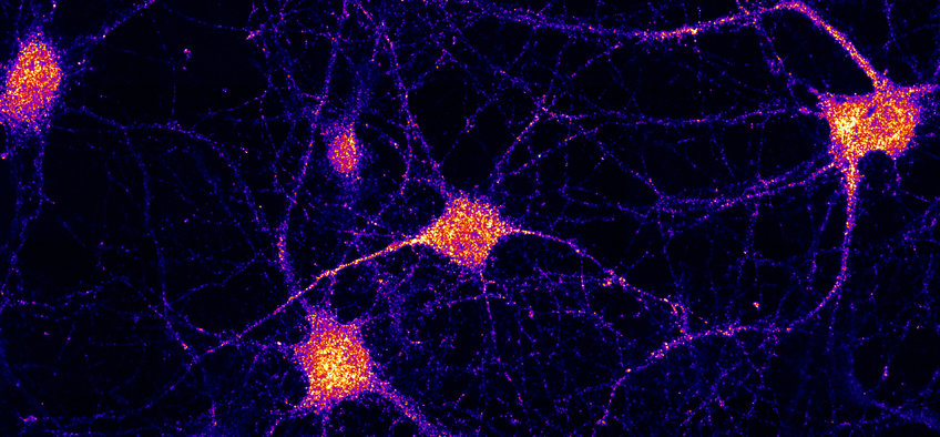 Logistik im Gehirn: Neuer Link erklärt mRNA-Transport in Gehirnzellen