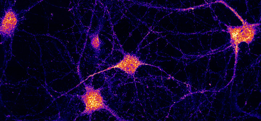 BRAIN LOGISTICS: Missing link explains mRNA delivery in brain cells BRAIN LOGISTICS: Missing link explains mRNA delivery in brain cells