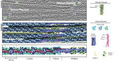 Struktur der dicken Filamente in einem entspannten Herzsarkomer. Das obere Bild zeigt einen tomographischen Schnitt eines Herzsarkomers. Dünne Filamente sind mit einem grünen und dicke Filamente mit einem violetten Pfeil markiert. Das mittlere Bild zeigt die rekonstruierten dicken (lila) und dünnen (grün) Filamente. Das untere Bild zeigt die Struktur des dicken Filaments, das sich über mehrere Sarkomerregionen erstreckt.