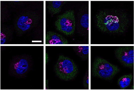 Orpinolide disrupts a leukemic dependency on cholesterol transport by inhibiting OSBP