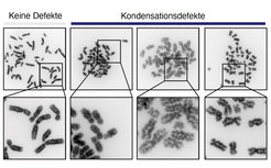 Bilder von Chromosomen ohne (links) und mit Kondensationsdefekten (rechts)