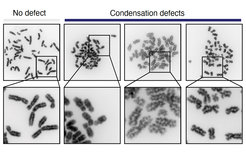 Images of chromosome spreads without (left) and with condensation defects (right)