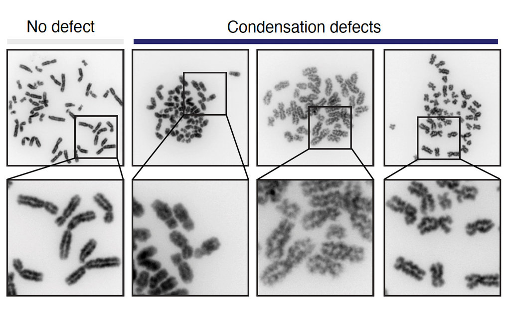 Bilder von Chromosomen ohne (links) und mit Kondensationsdefekten (rechts)